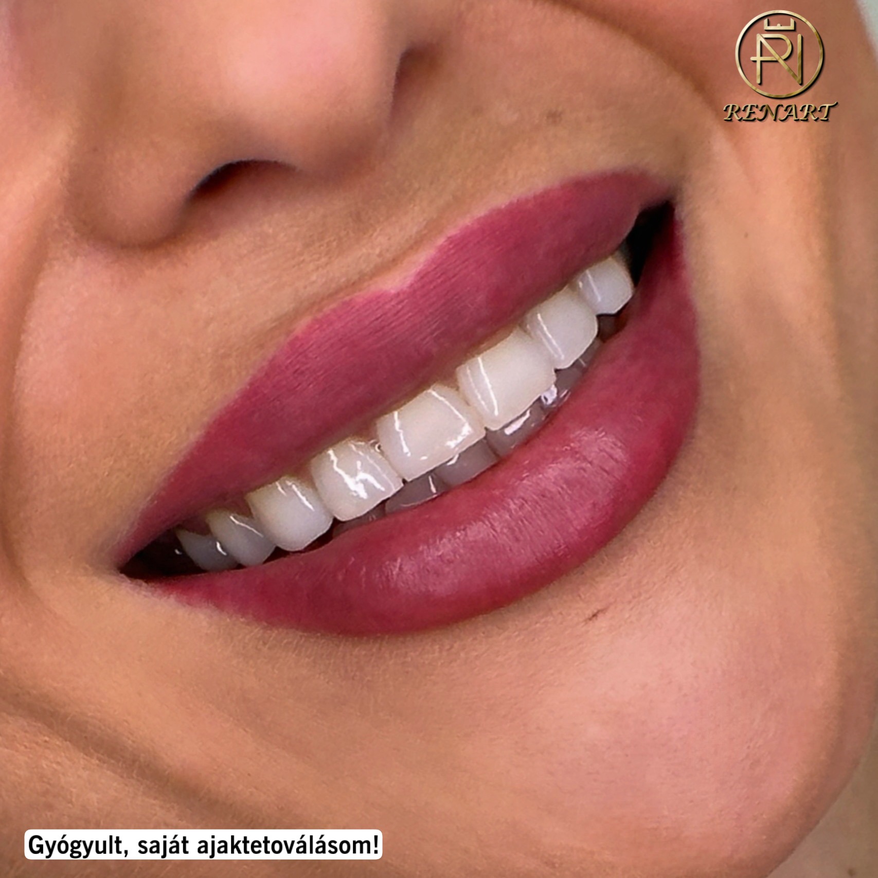 FEC0A546-BA98-4A61-8EA5-8D0D4530AF49